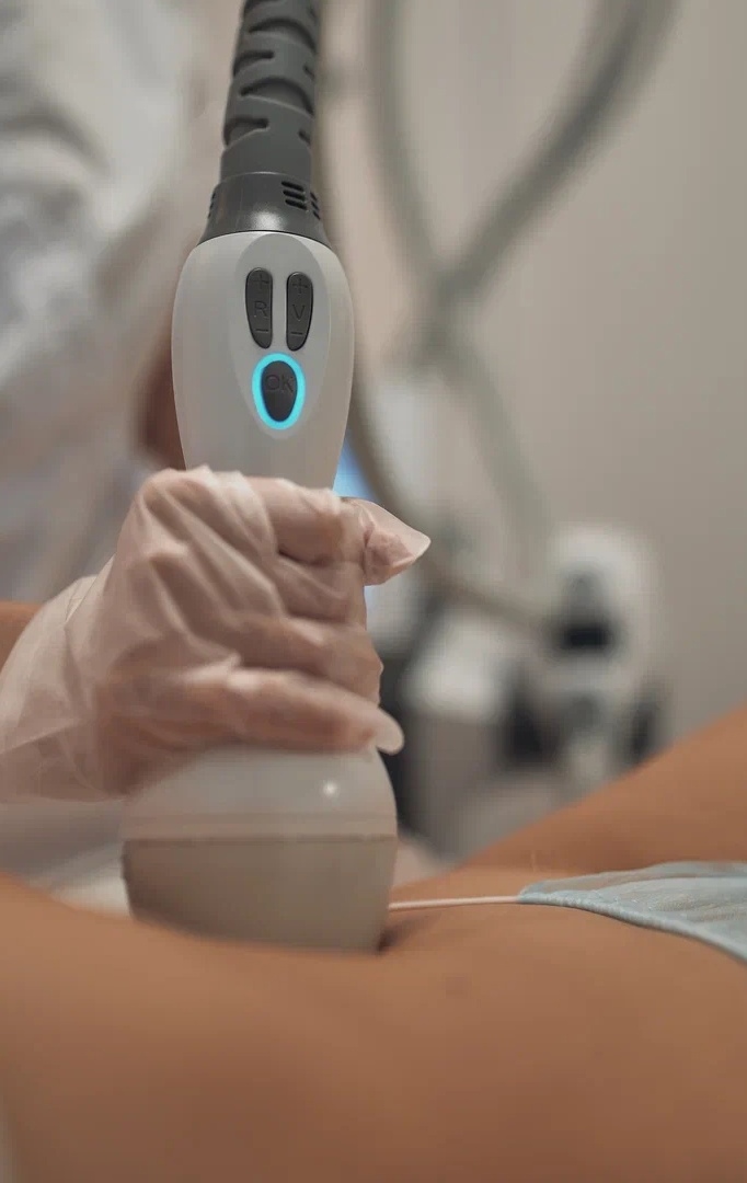 RF-лифтинг тела